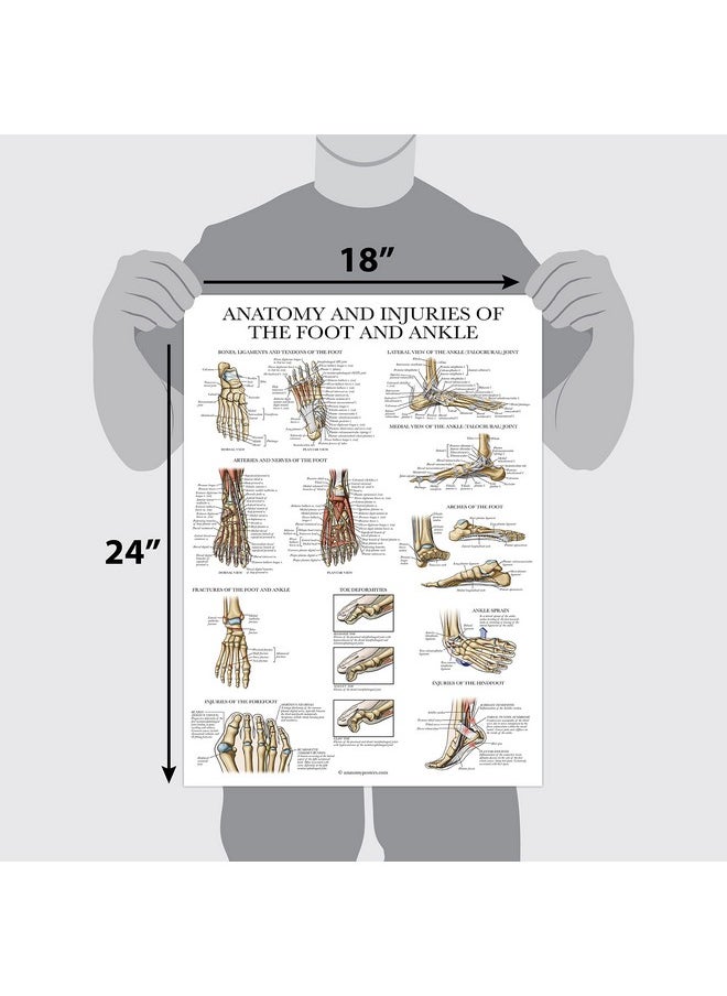 Palace Learning Palace Learning Laminated Anatomy and Injuries of the Foot and Ankle Poster - Anatomical Chart of Foot and Ankle Joint - 18" x 24"  - Image 2