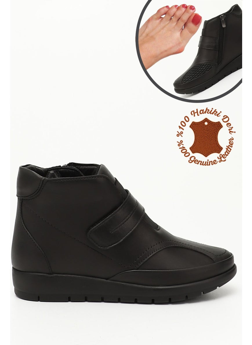 Gönderi(r) Post(R) Anatomical Sole Bone Protrusion Special Boot 42907  - Image 1
