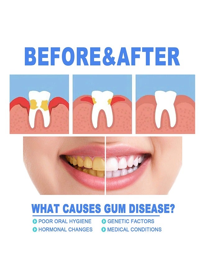 EELHOE Gum Protect Repair Gels-Teeth Whitening,Remove Deep Dirt ,Restore Oral Health for Men and Women 4ml - Image 4