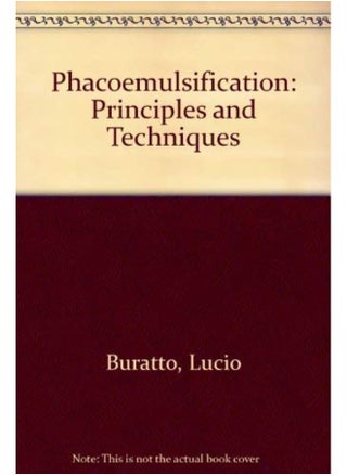 Phacoemulsification: Principles and Techniques - pzsku/ZBD5C6938228A516A19C0Z/45/_/1727804349/4f3b0573-8c99-4081-b2ea-5ad6d9af77ee