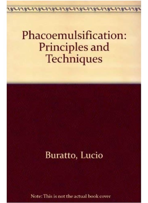 Phacoemulsification: Principles and Techniques