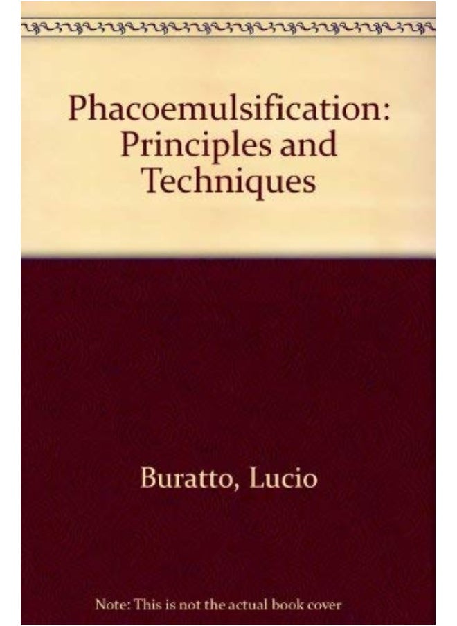 null - Phacoemulsification: Principles and Techniques - Image 1