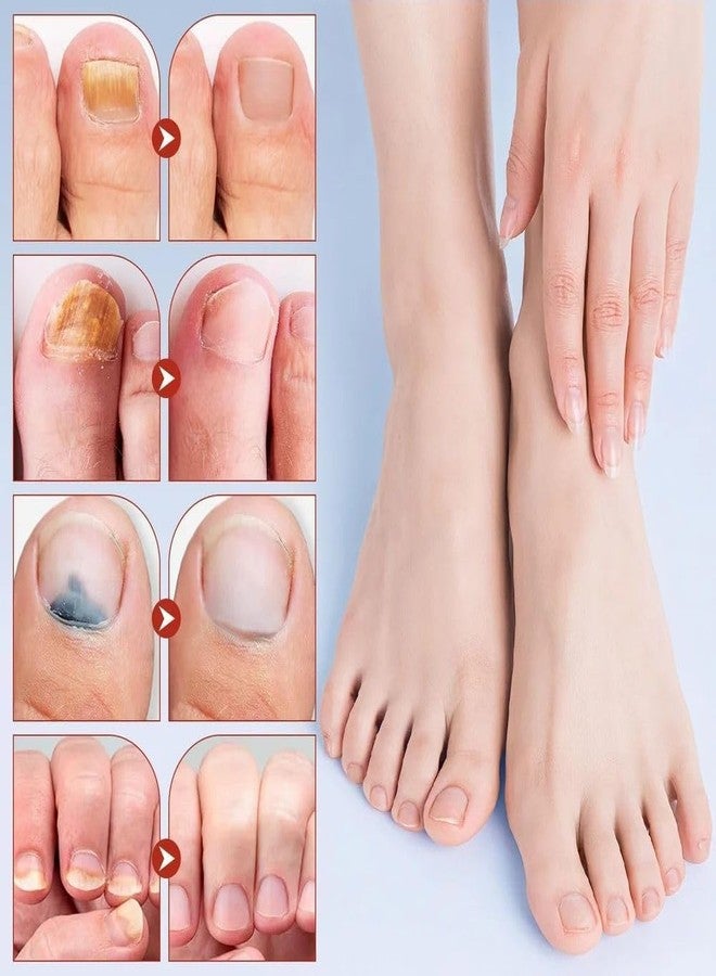 BYKOINE 21 Pcs Fungal Nail Patches - Overnight Nail Repair & Strengthening Treatment Fungal Nail Repair Patches - Overnight Treatment for Brittle & Discolored Nails (21 Pcs) - Image 4
