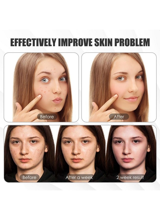 Bvcewilty Red Light Therapy For Face 7 Colors Light Therapy Facial Mask For Skin Care At Home  - Image 2