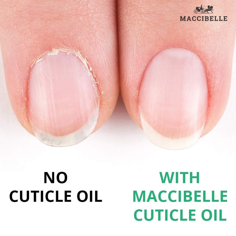 Maccibelle Pure Cuticle & Nail Oil Pen 2ml Heals Dry Cracked Cuticles (Crisp Lemon) - Image 4