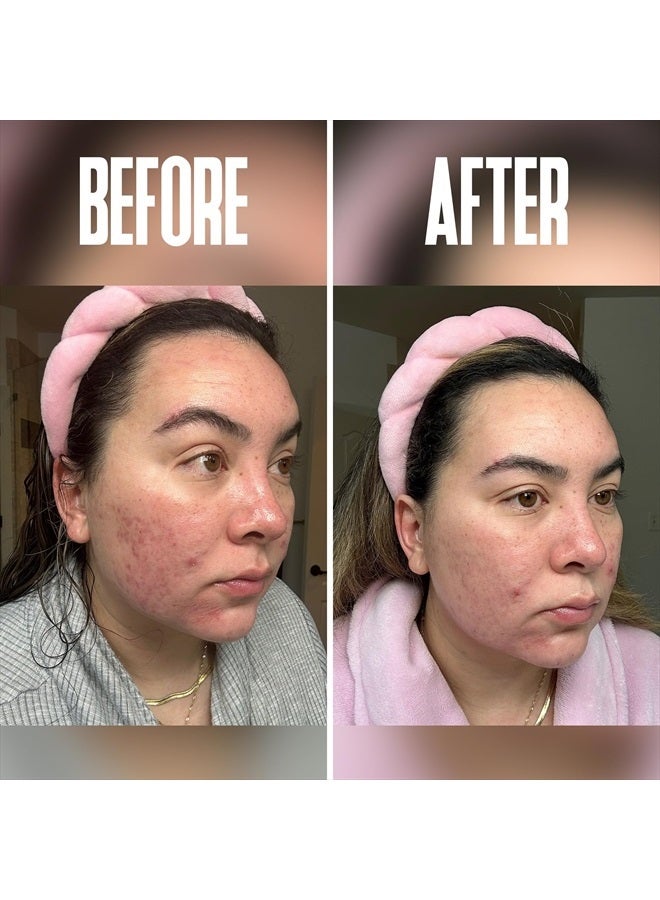 DIVINE DERRIERE Glycolic Acid Pads, Chemical Peel for Face at Home with 20% Glycolic Acid and Vitamin C - Exfoliating Face Pads, Glycolic Acid Peel for Face Exfoliating Pads -Face Cleansing Pads 50 Cotton Facial Pads - Image 4