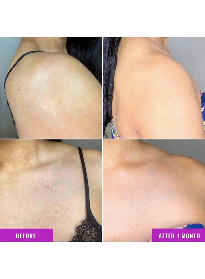 علاج الجسم لتصحيح تغير لون البشرة من Good Molecules - كريم يحتوي على ملح إستر حمض الترانيكساميك، وحمض الليبوهيدروكسي، والنياسيناميد - عناية بالبشرة مضادة للشيخوخة للجسم - Image 4