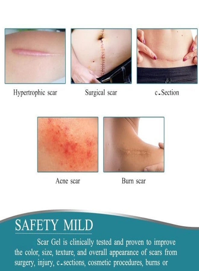 QUEBERS Silicone Scar Sheets | Medical-Grade Scar Removal Tape for Surgical Scars, C-Section, Tummy Tuck, Acne & Keloids | Reusable Silicone Scar Strips Safe & Effective Scar Treatment - Image 5