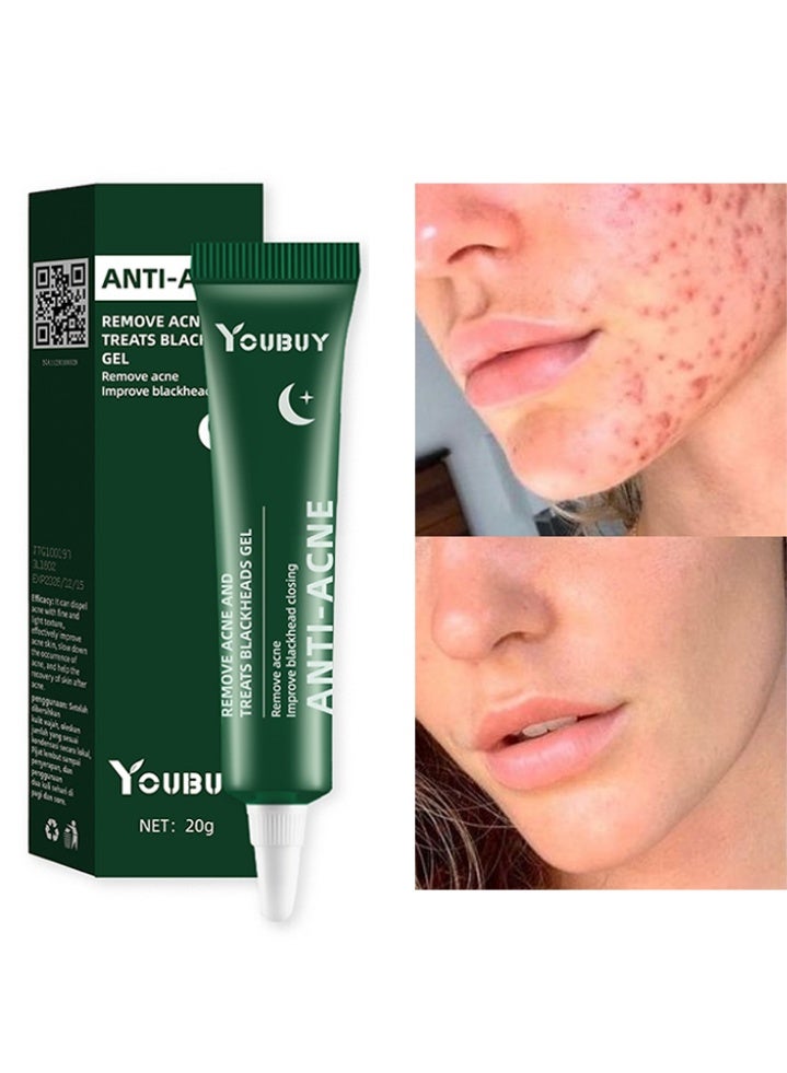 Youbuy مضاد لحب الشباب يزيل حب الشباب ويعالج الرؤوس السوداء جل الاستخدام الليلي يزيل حب الشباب والبثور ويعالج الرؤوس السوداء بحمض الساليسيليك يتحكم في زيت تقليص المسام تخفيف احمرار البشرة تفتيح الندبات كريم تتلاشى حب الشباب كريم مزيل حب الشباب 20 جم - Image 1