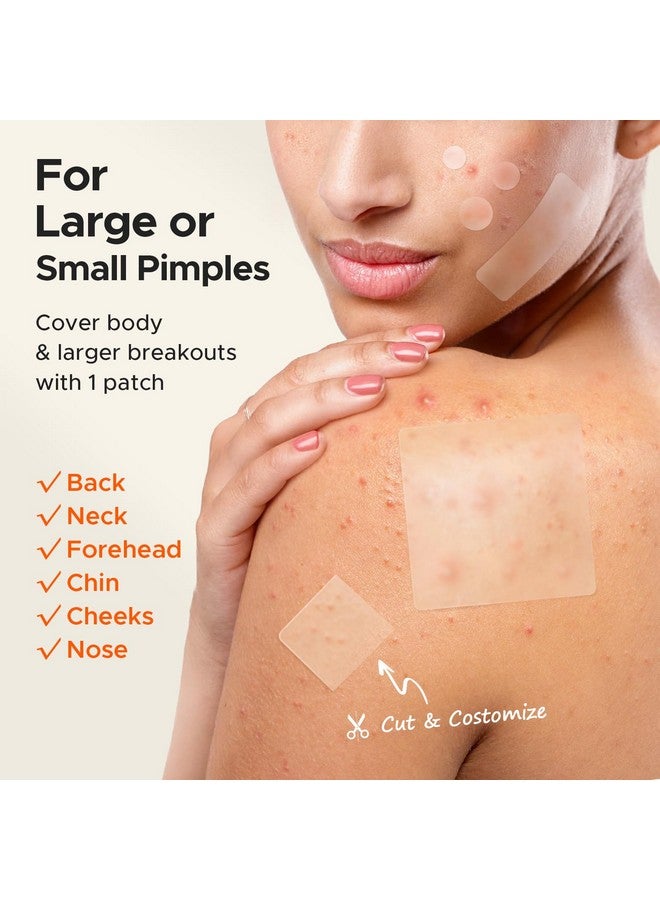 تي كيه تي كيه رقعة حب الشباب الكبيرة من TKTK، رقعة حب الشباب الكبيرة مقاس 60 مم، ضمادات هيدروكولويد كبيرة للجسم والوجه والجبهة والذقن والرقبة، رقعة هيدروكولويد (مربعة، شريطية، نقطية، 5 مقاسات، 265 قطعة) - Image 3