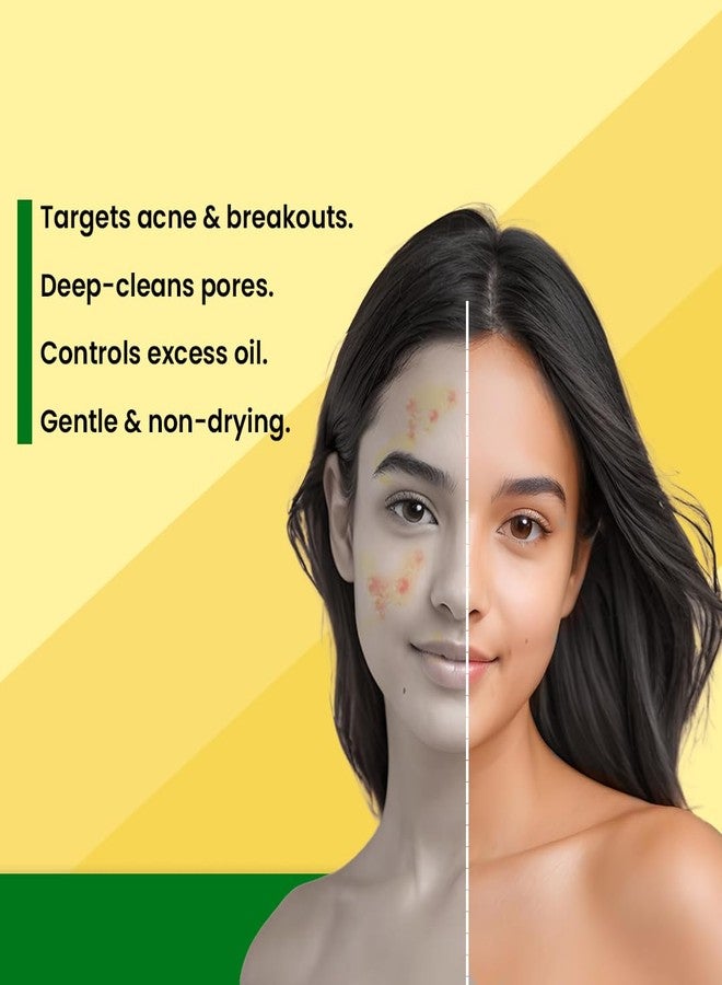 Adven Naturals D-Acne Soap 75g X 6 - Image 4