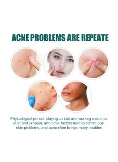EELHOE Colorful Acne Patch, Star-Shaped Acne Patch, Acne Repair Patch, Pimple Patch (112 Patches)  - Image 5