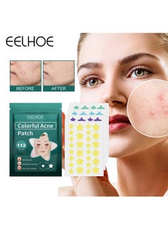 EELHOE Colorful Acne Patch, Star-Shaped Acne Patch, Acne Repair Patch, Pimple Patch (112 Patches)  - Image 1