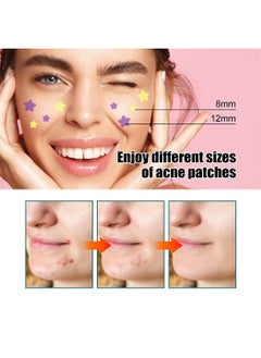 EELHOE Colorful Acne Patch, Star-Shaped Acne Patch, Acne Repair Patch, Pimple Patch (112 Patches)  - Image 4