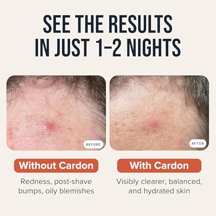 Cardon Microneedle Patches - Microdart Acne Patch with Salicylic Acid, Niacinamide & Hyaluronic Acid - Korean Pimple Patches to treat Zits, Blackheads, Blemishes, Razor Bumps, Ingrown Hair - (9 count) - Image 5