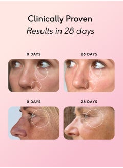 FEEL Feel Pro Collagen Sachets, Watermelon Flavour Collagen Supplement, 5g Per Serving, Vegan, Anti-Wrinkle Support, Increased Skin Elasticity, Revive and Support Hair And Nail Growth (30 Sachets)  - Image 4