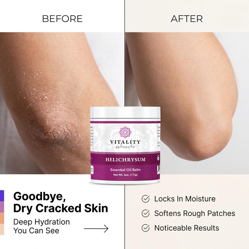 Vitality Extracts Helichrysum Balm - 6oz, Helichrysum Gymnocephalum, Beeswax, Almond Oil, Ultra-Moisturizing, Skin Healing, Full Body Hydration - Image 4