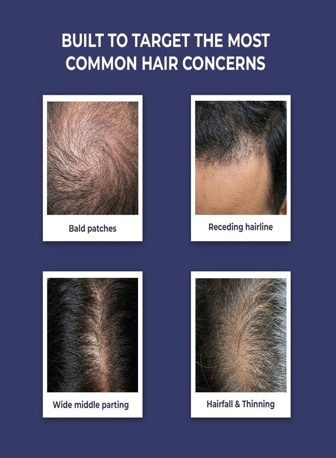 Conscious Chemist® Hair Growth Combo | Anti Hair Fall Shampoo & Hair Serum Kit | Saw Palmetto, Rosemary, Keratin, Redensyl, Anagain & Biotin | Controls Hair Fall, Boosts Growth & Density | Hard Water Safe | Paraben & SLS Free | For Men & Women - Image 2