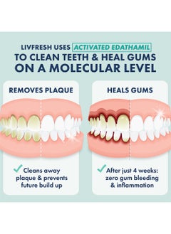 LIVFRESH Livfresh Wintergreen Foaming Gel 50g, Toothpaste Dental Gel, Clinically Proven to Remove Plaque 250% Better, Improves Gum Health 190% Better, Prevents & Reduces Tartar, Freshens Breath, SLS Free, Sugar Free  - Image 3