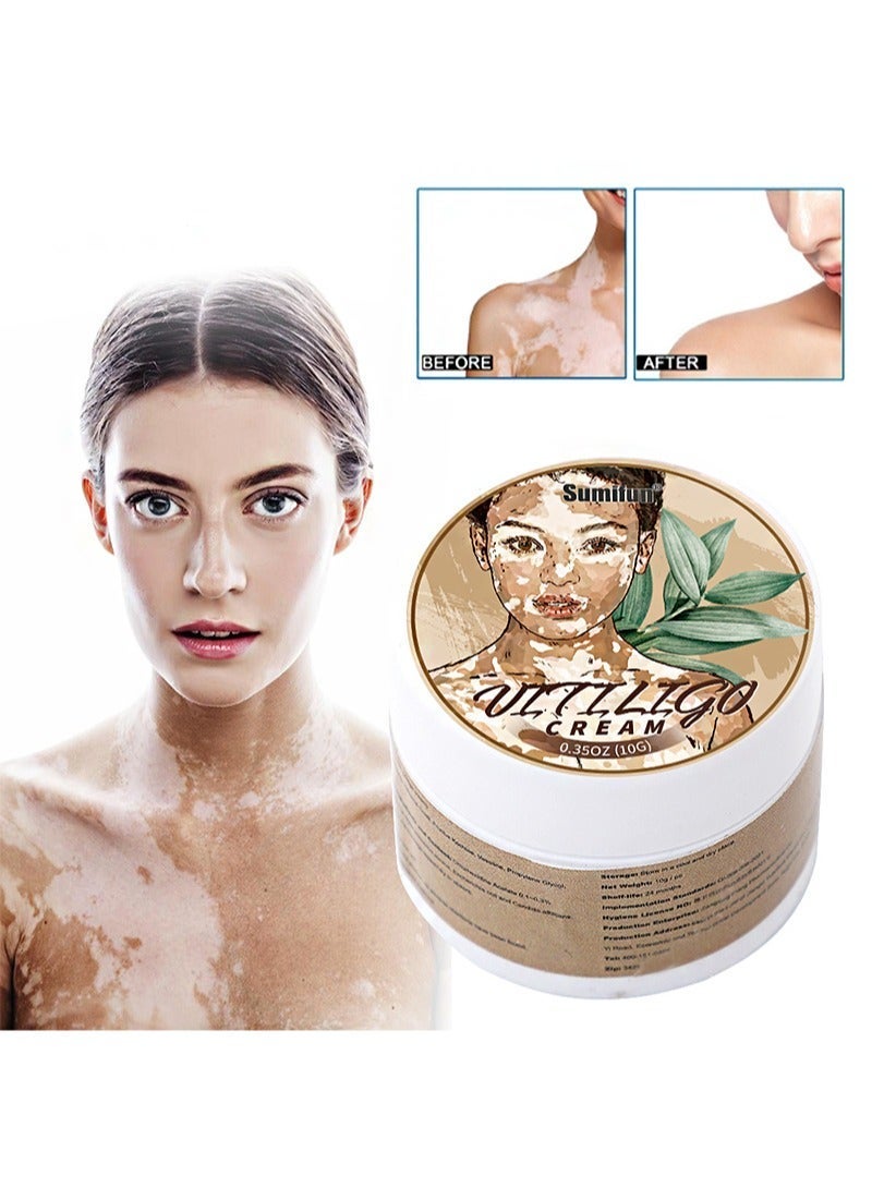 Sumifun Vitiligo Care Cream For White Spots On Skin，Gentle and Non-irritating，Regulating & Improve Skin Pigmentation，Reduces White Spots on Skin (10g) - Image 1