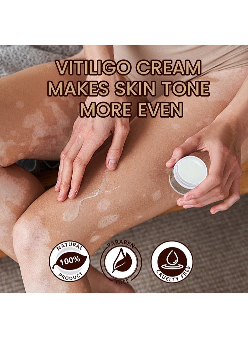 Sumifun Vitiligo Care Cream For White Spots On Skin，Gentle and Non-irritating，Regulating & Improve Skin Pigmentation，Reduces White Spots on Skin (10g) - Image 4