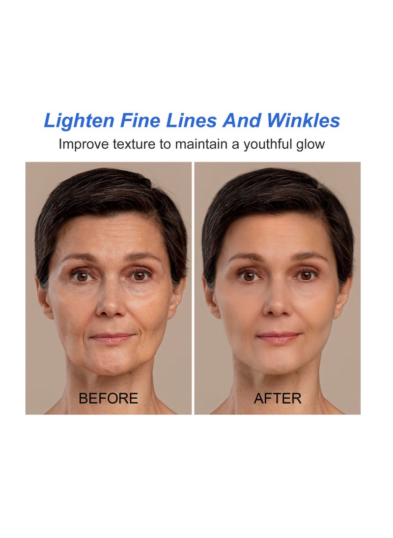 Botox Stock Solution for Lightens Fine Lines,Improves Nasolabial Folds,Anti-wrinkles