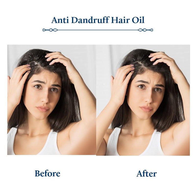 Blue Nectar Anti Dandruff Hair Oil with Neem Tea Tree Hair Oil Ayurvedic NonSticky Hair Oil for Dry Scalp and Dandruff Plant Based Hair Oil for Men Women 12 Herbs 200ml - Image 4
