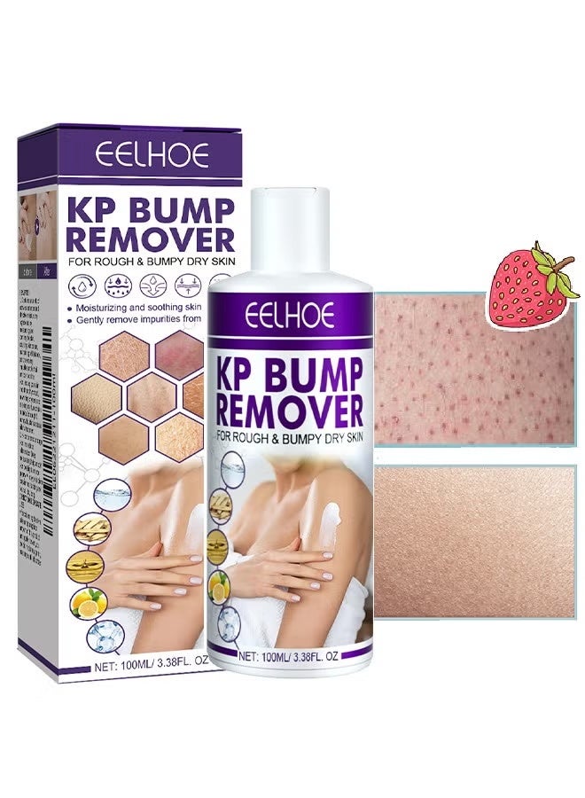 EELHOE KP Bump Remover - 100ml Pilaris Keratinizing Moisturizer with Lactic Acid - Exfoliating and Moisturizing Cream for Problematic Keratinization, Dry, Rough and Bumpy Skin 100ml - Image 1