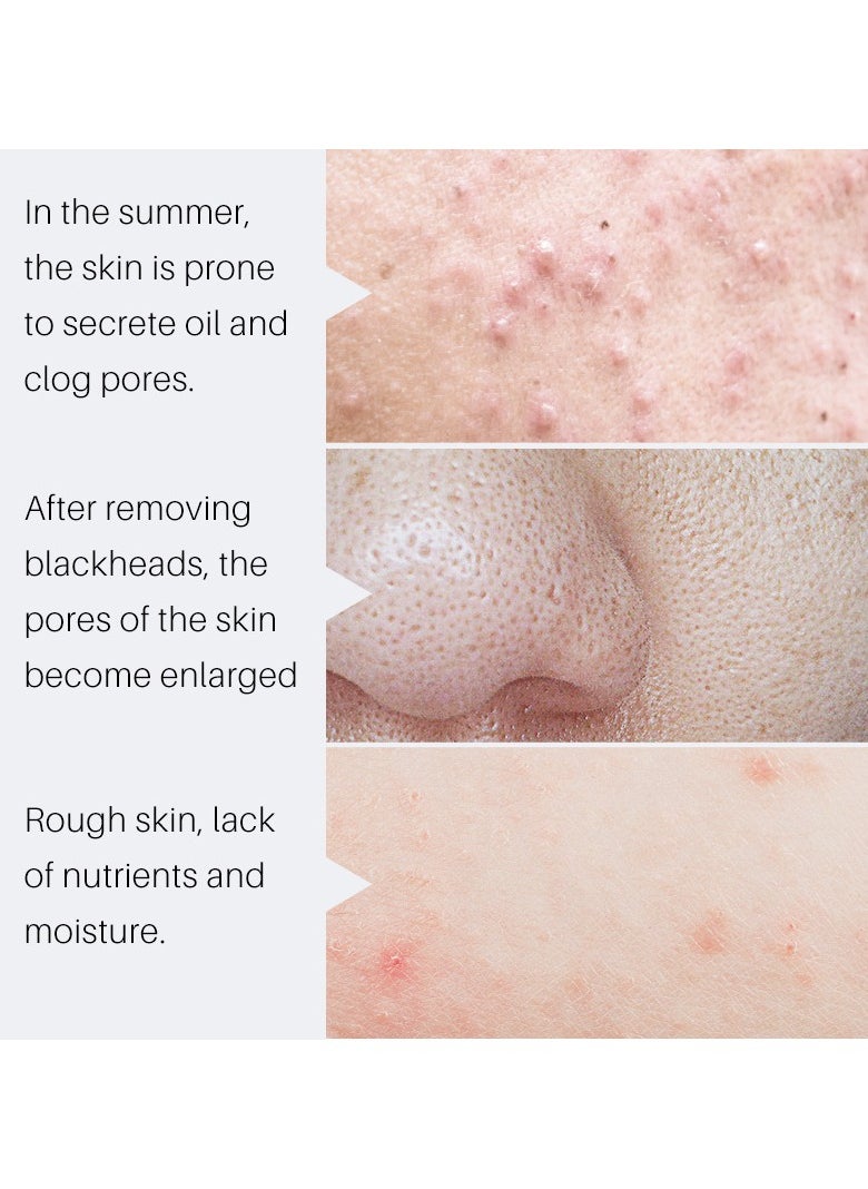 SAUVASINE - Pore Minimizer Pore Control Serum Essence Refining Skin Reducing Pores Preventing Enlarged Pores Repairing Facial Skin Moisturising Skin Care - Image 1