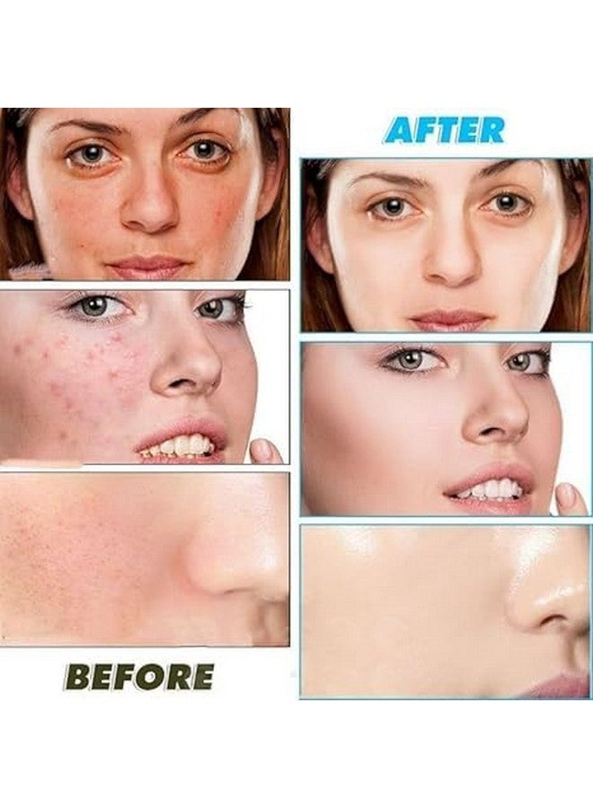 Veemok Turmeric & Kojic Acid Face Cleansing Pads - Dark Spot Remover, Skin Brightening & Exfoliating | With Vitamin C, Retinol & Chamomile | Acne Control for All Skin Types (60 Pads) - Image 5