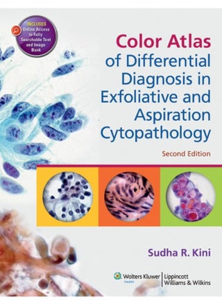 Color Atlas of Differential Diagnosis in Exfoliative and Aspiration Cytopathology - pzsku/ZBDF11A4BDB3F06AB591DZ/45/_/1727803360/e160cc9f-0ceb-4047-a444-316b47f908f3