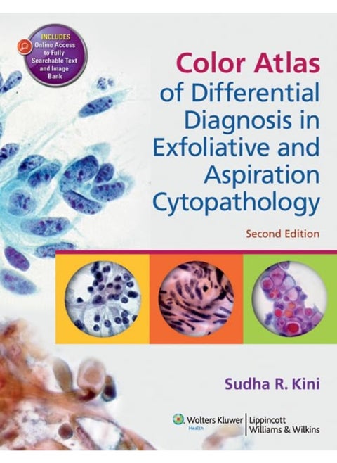 Color Atlas of Differential Diagnosis in Exfoliative and Aspiration Cytopathology