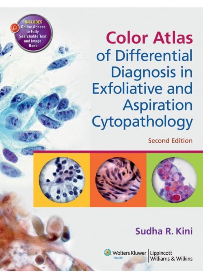 Color Atlas of Differential Diagnosis in Exfoliative and Aspiration Cytopathology