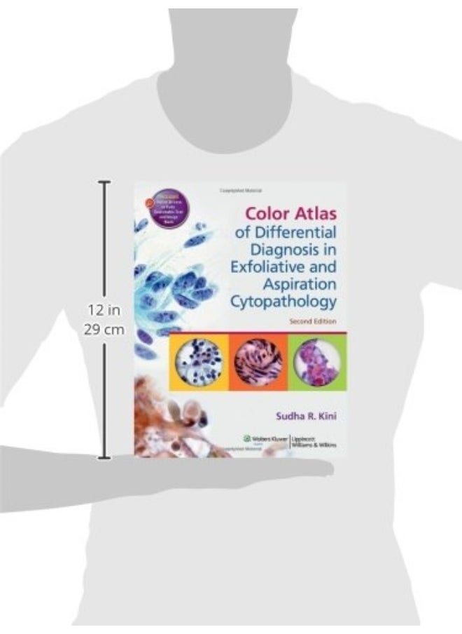 Color Atlas of Differential Diagnosis in Exfoliative and Aspiration Cytopathology