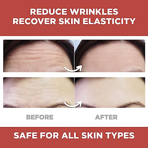 Vitalogy - Forehead Wrinkle Patches, Face Wrinkle Patches, Smooth Forehead to Smooth Fine Lines & Wrinkles, Natural Anti-Wrinkle Forehead Patches with Hydrolyzed Collagen for Men & Women - 6 Patches - Image 3