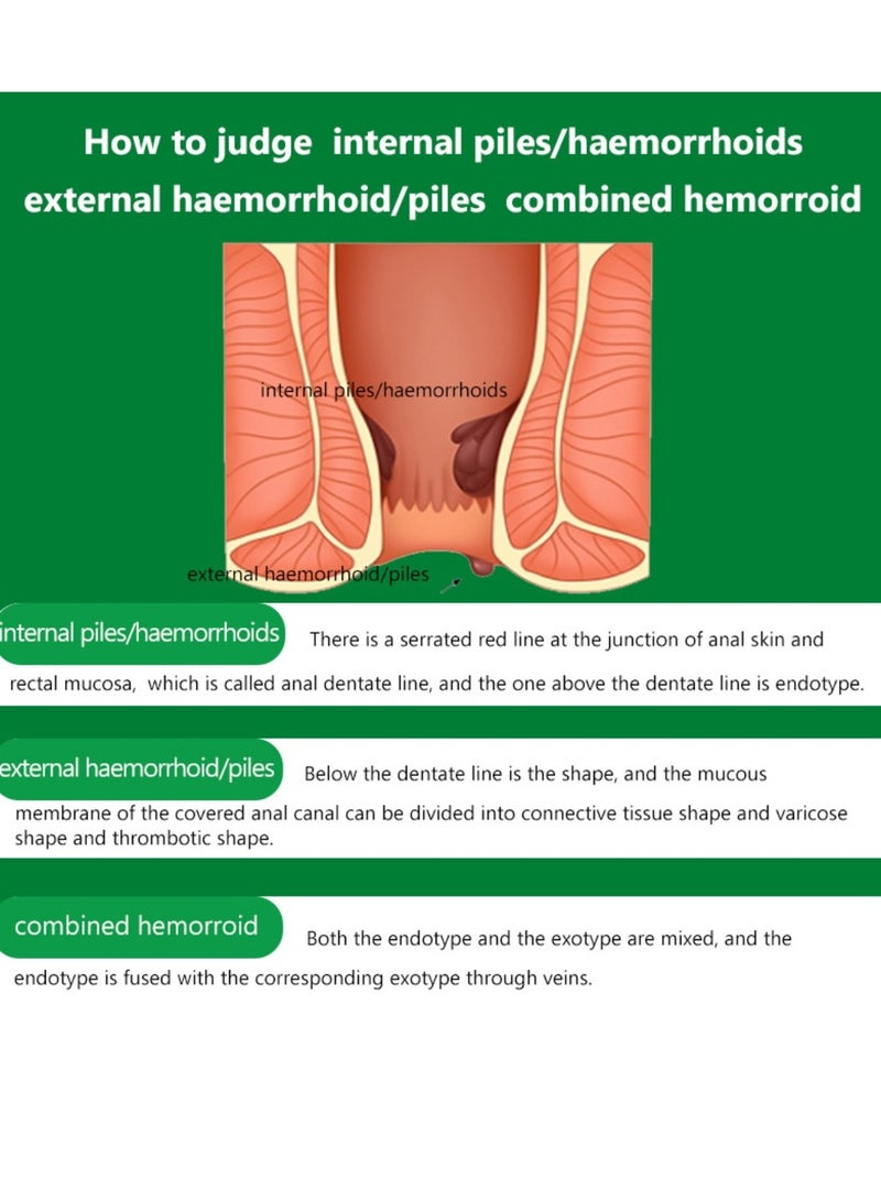 DERMFREE Hemorrhoid Ointment 42.5g Hemorrhoid Treatment Hemorrhoid Cream for Hemorrhoid Discomfort, Cooling Formula with Soothing Ingredients Targets Pain Swelling and Itching Fast Acting Ointment  - Image 5