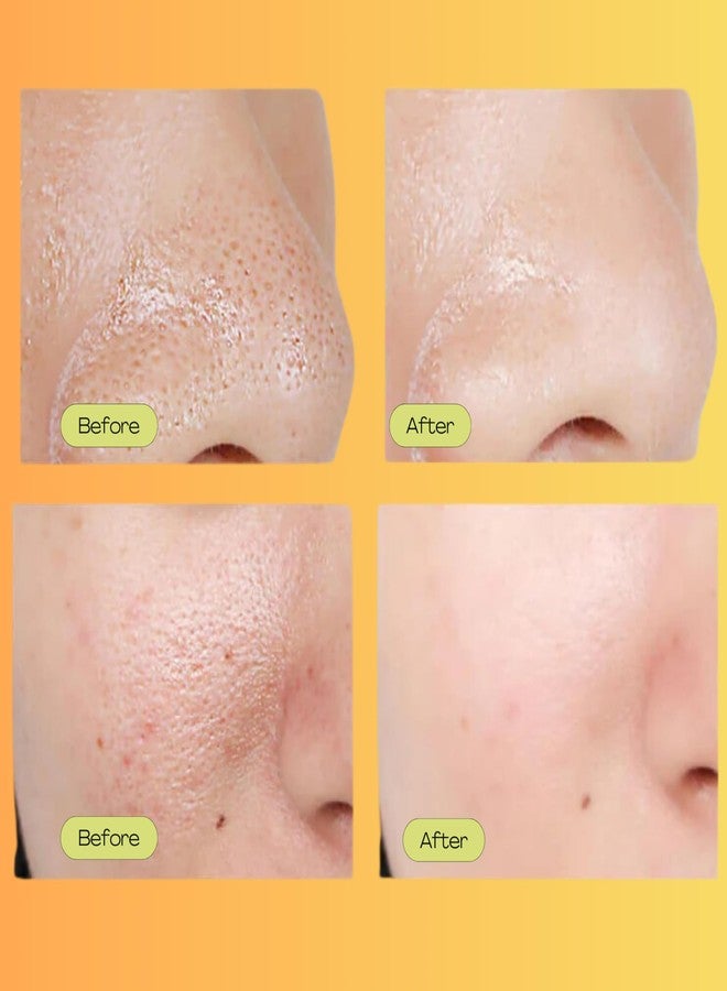 Luelle Pore Minimizer, Facial Essence for Minimizing the Appearance of Pores, Pore Minimizer Serum for Face, Even Skin Tone, Relieving Dryness, Oil Control Firming - Image 3