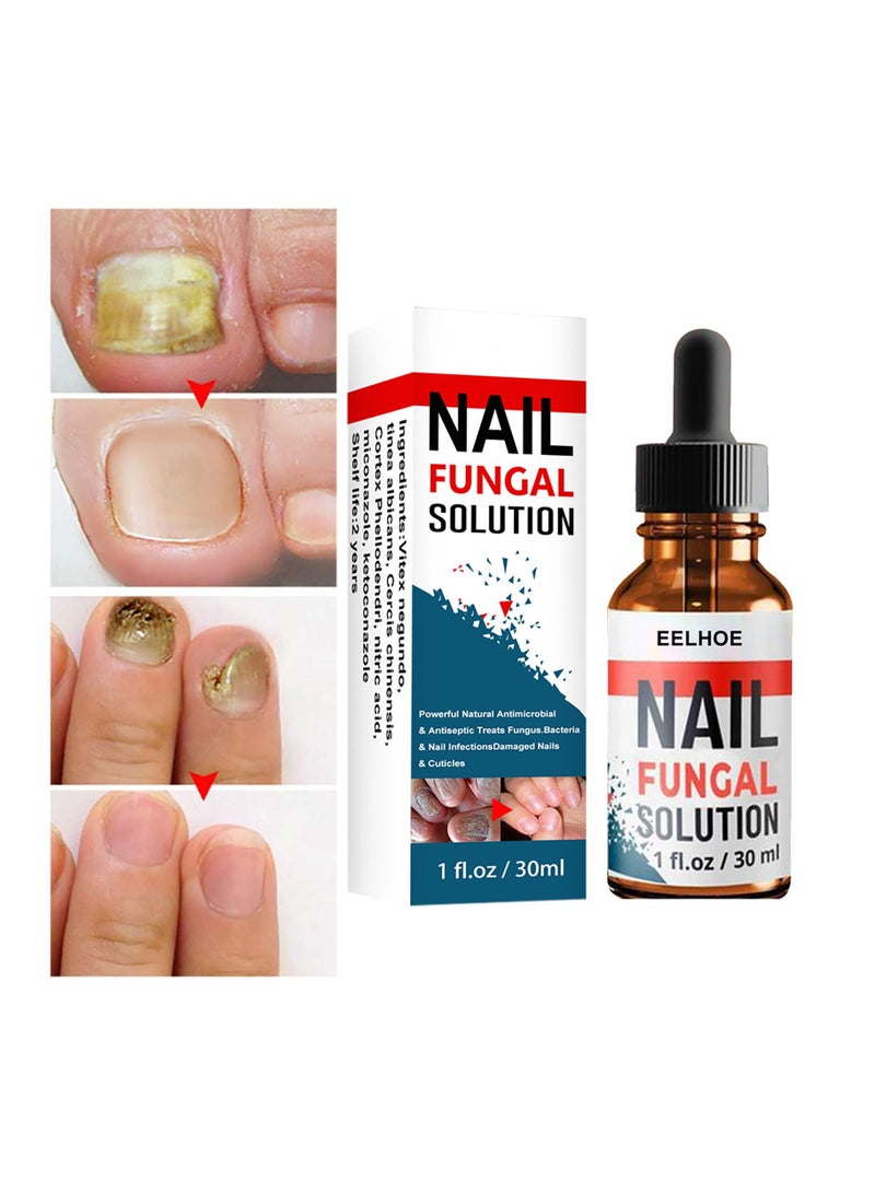 EELHOE Nail Repair Solution Onychomycosis Care - Image 1