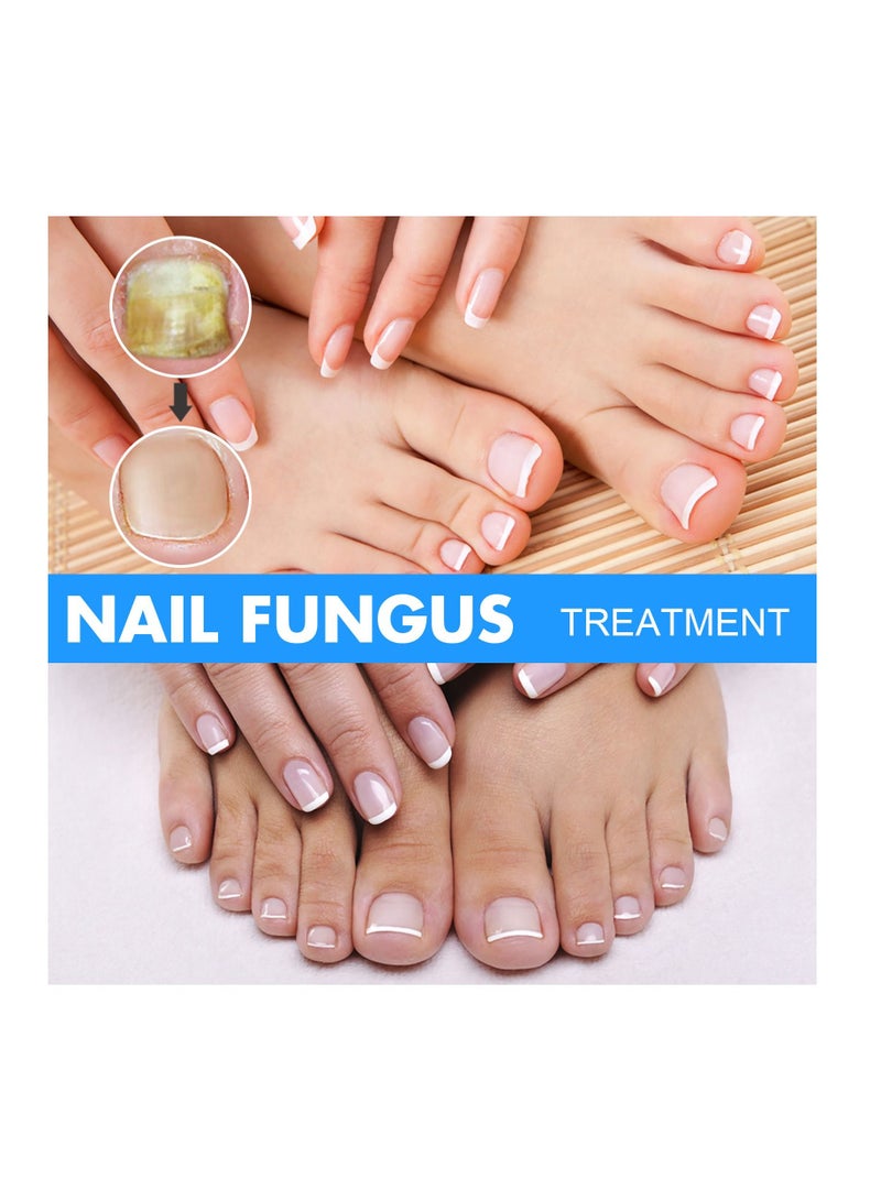 EELHOE Nail Repair Solution Onychomycosis Care - Image 4