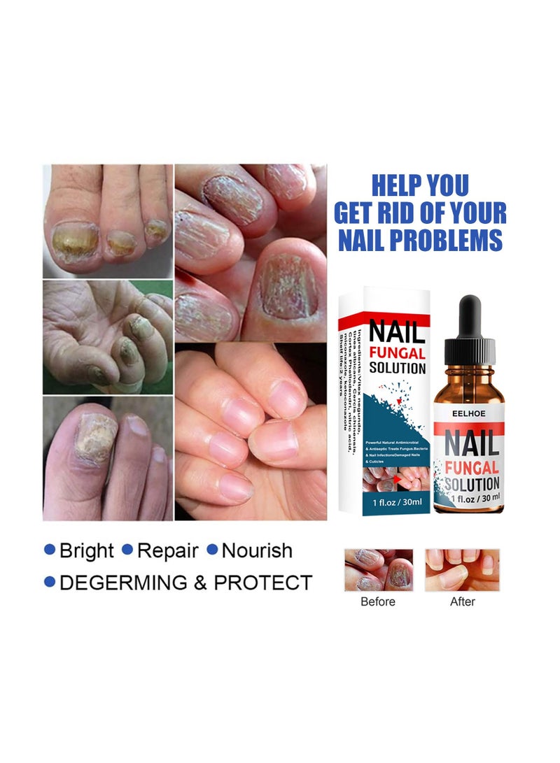 EELHOE Nail Repair Solution Onychomycosis Care - Image 2