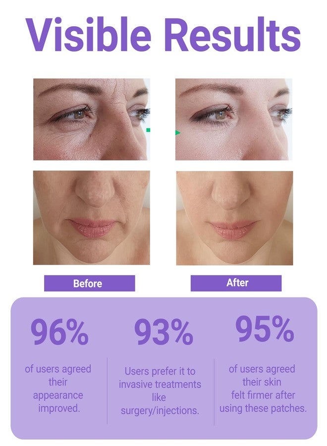 Sfuchin 125 Pcs/Roll Collagen Anti Wrinkle Patches - 2026 New Version Pre Cut Face Tape for Wrinkles Overnight, Smooth Fine Lines and Firm Lift Skin, Smile Line Forehead Eye Lip Multi Area Use - Image 5