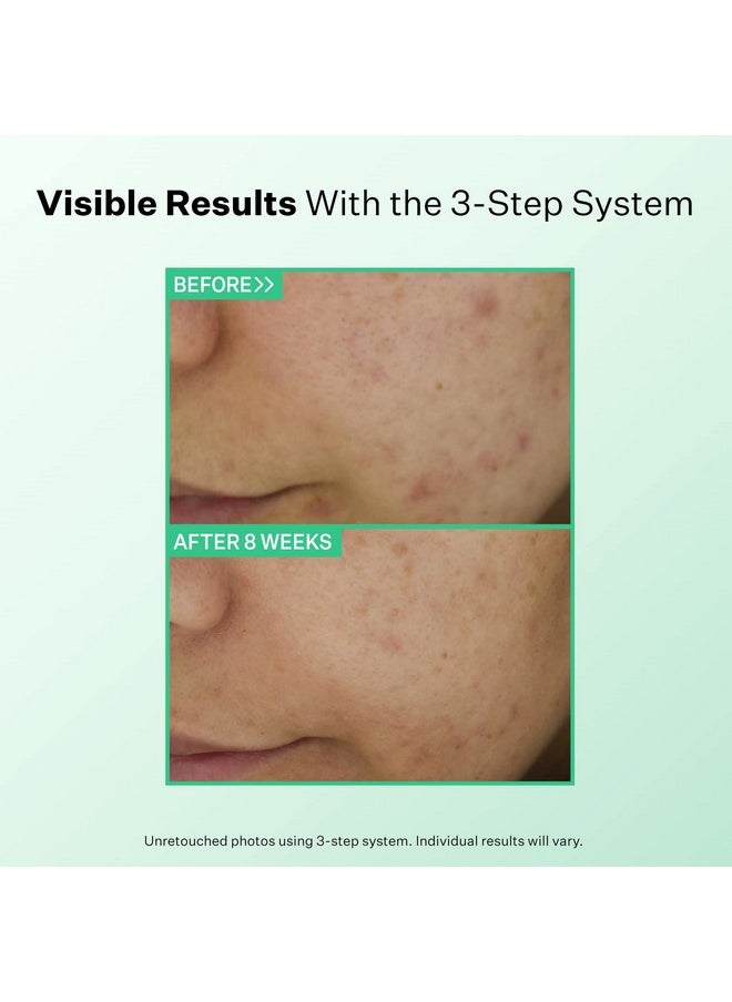 Strivectin StriVectin Multi-Action Clear Gentle Daily Clarifying Cleanser for Acne Blemished Skin and Break Outs, 5 fl oz  - Image 2