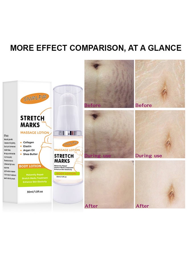 SNMLPM Stretch marks cream - Image 2