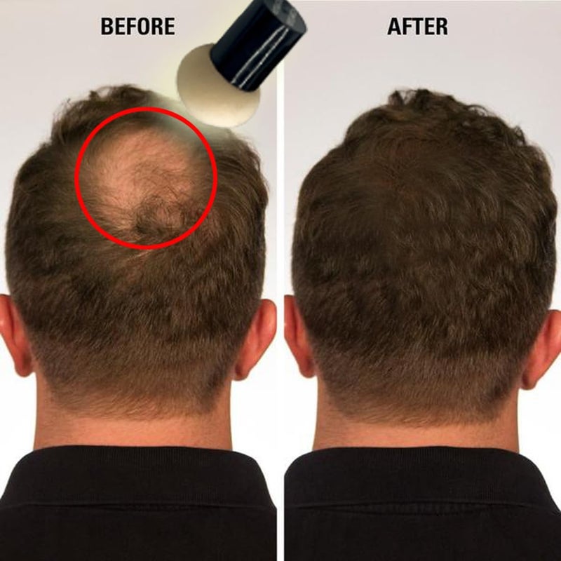 KERATIN RESEARCH Hairline Filler Unisex Mineral Powder Root Touch-Up Hair loss Concealer Scalp & Beard Bald Patch Coverage Fibers for Thinning Hair Waterproof Organic Natural look (BLACK, XL) - Image 3