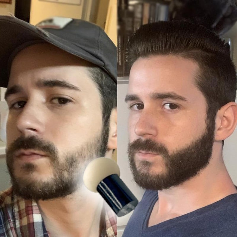 KERATIN RESEARCH Hairline Filler Unisex Mineral Powder Root Touch-Up Hair loss Concealer Scalp & Beard Bald Patch Coverage Fibers for Thinning Hair Waterproof Organic Natural look (BLACK, XL) - Image 5