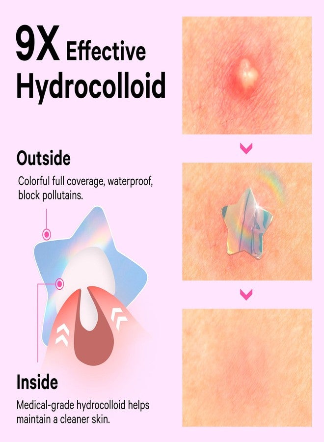 Sosky Hologram Pimple Patches for Face, Hydrocolloid Acne Patches with Salicylic Acid, Cute Star Zit Stickers,Colorful Blemish Covers,144 Count Pink Star Heart Moon Cloud Butterfly Flower - Image 3