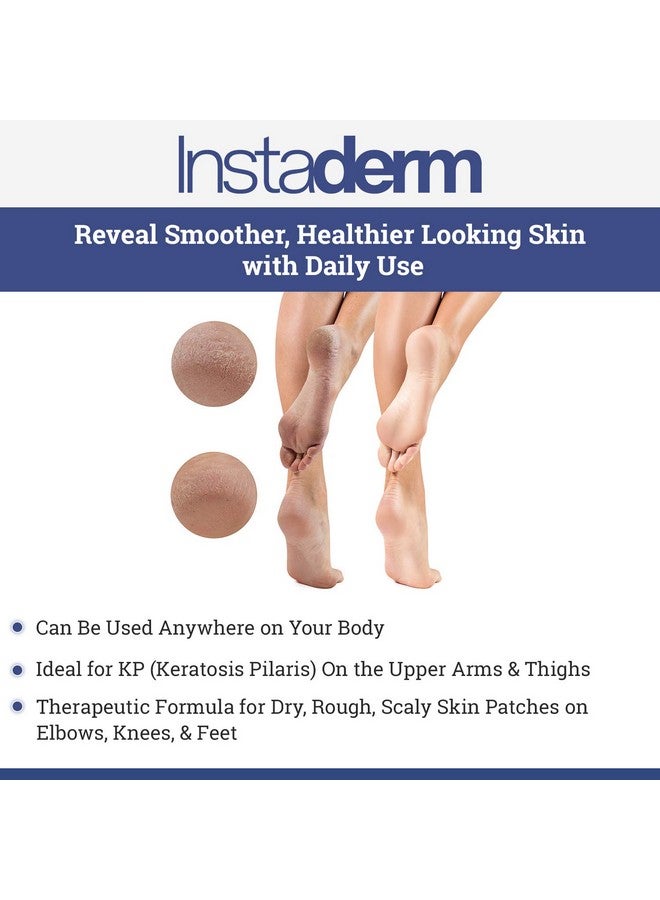 Instaderm Keratosis Pilaris Treatment- Kp Bump Eraser. Smoothing Exfoliating Moisturizing Lotion For Rough, Dry, Flakey & Bumpy Skin Conditions With Lactic Acid, Aha. Smooth Skin Body Cream.