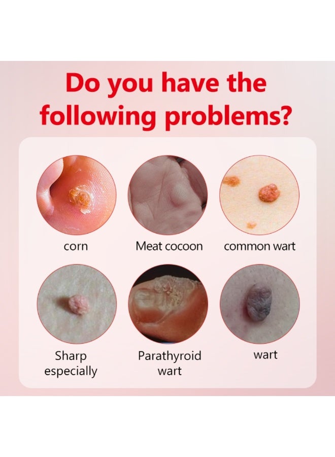 DERMFREE Wart and Corn Remover Pads for Toes Feet 40% Salicylic Acid Extra Strength Bandages Corn Callus Wart Remover Cushions Patches for Plantar Foot Safe Effective Treatment Rapid Wart and Corn Removal Pads 42Pcs - Image 3