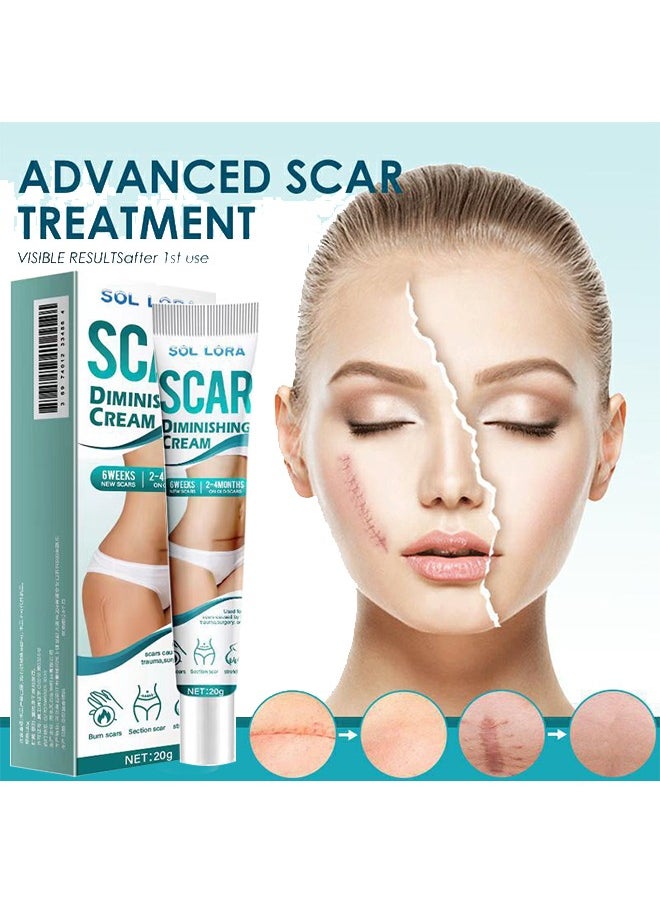SOL LORA - Scar Diminshing Cream - Skin Repair Creams Treatment Stretch Marks Acne Surgical Care 20g - Image 1