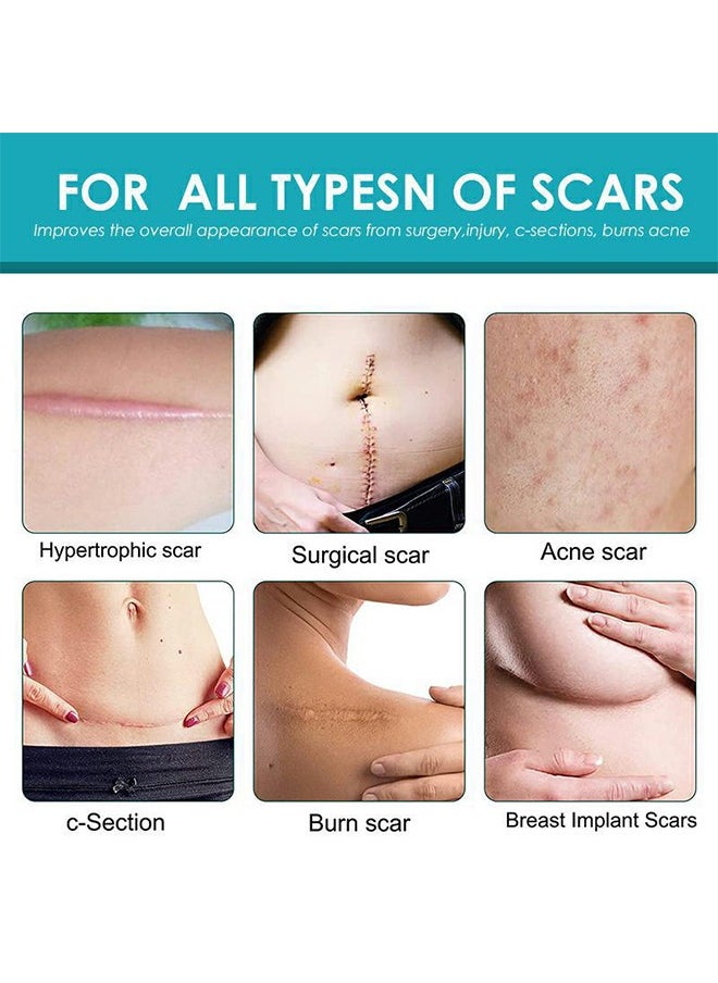 SOL LORA - Scar Diminshing Cream - Skin Repair Creams Treatment Stretch Marks Acne Surgical Care 20g - Image 1